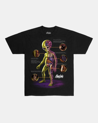 Alien Autopsy Redux T-Shirt (Black)